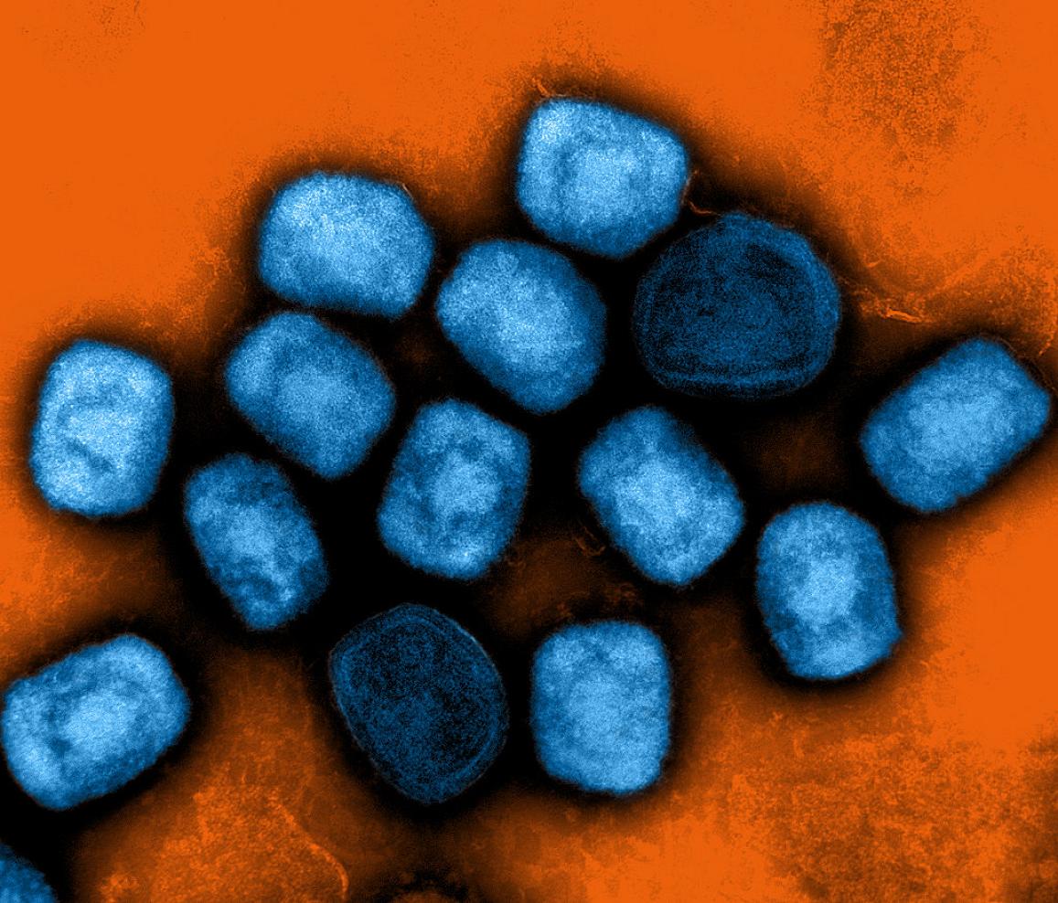Partículas del virus mpox observadas mediante microscopía electrónica